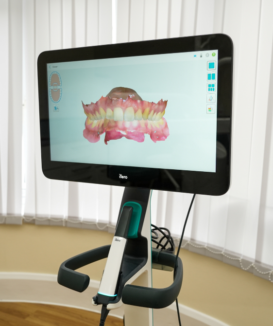 benefits of invisalign