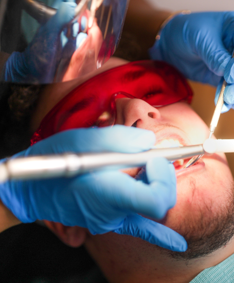 specialist root canal